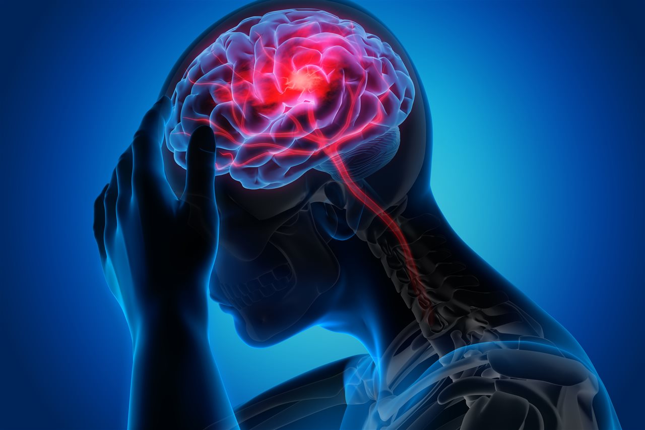 Can You Recover From A Mild Brain Injury