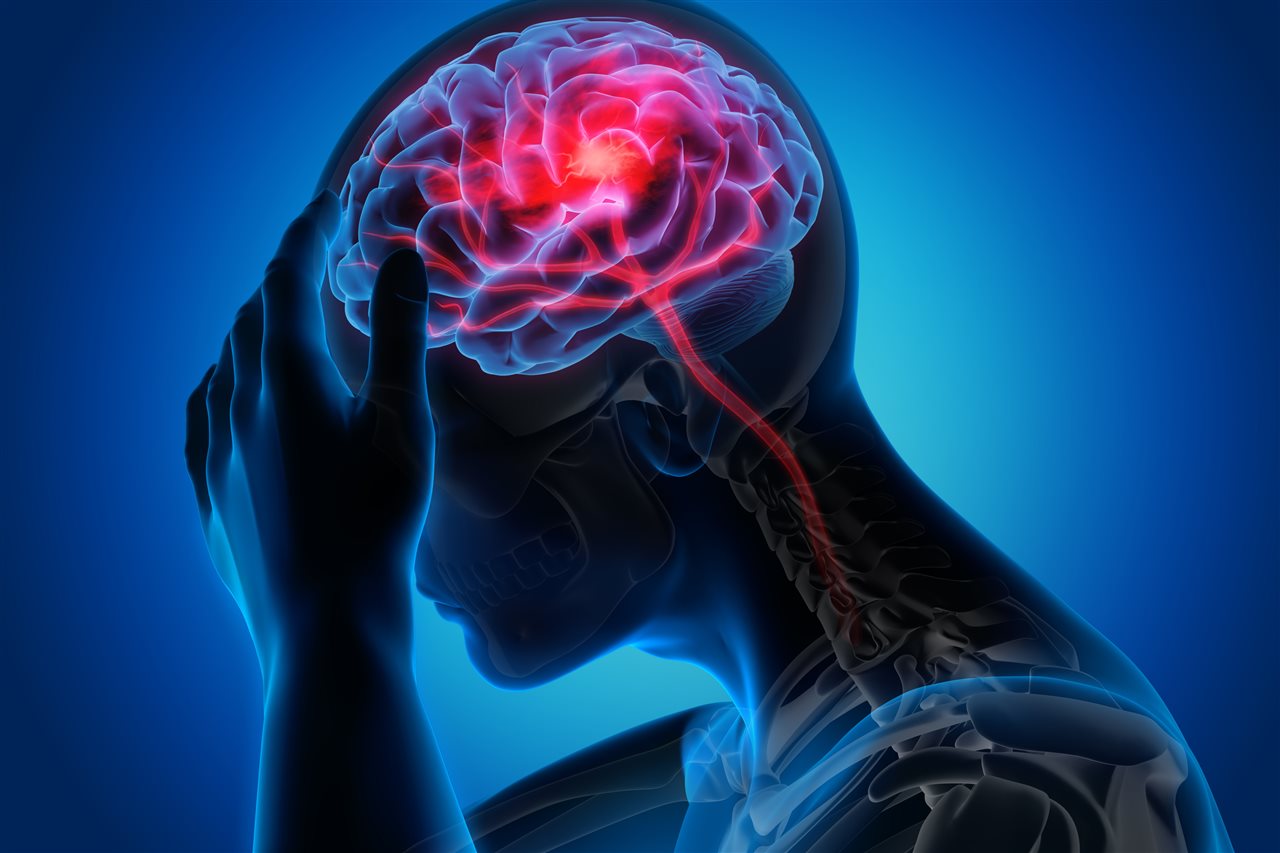The personal and economic burden of traumatic brain injury